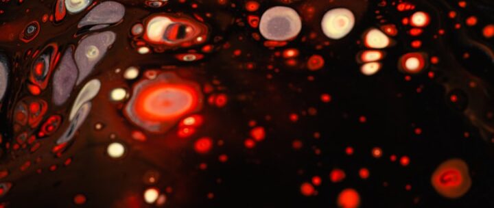 Sd-LDL 超壞膽固醇檢查